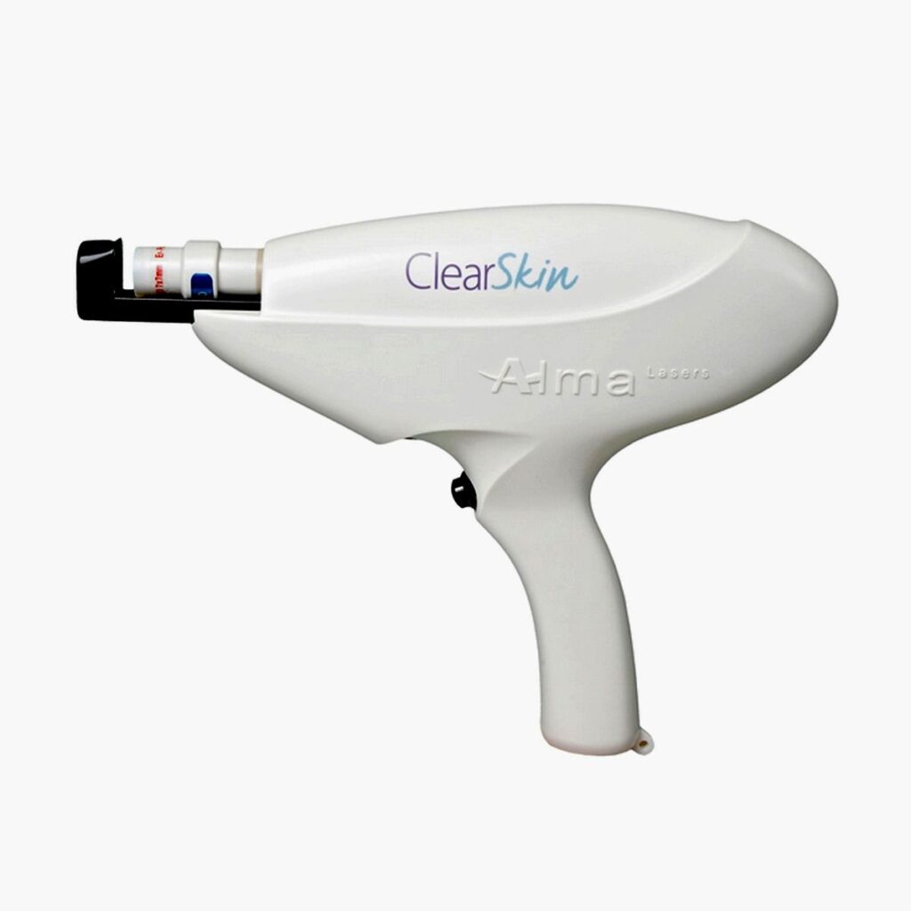 clear skin