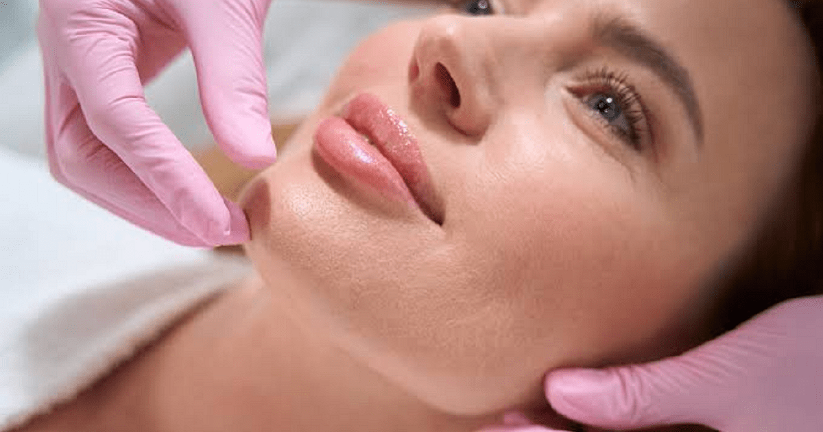 Best Age for Lip Fillers When Should You Start