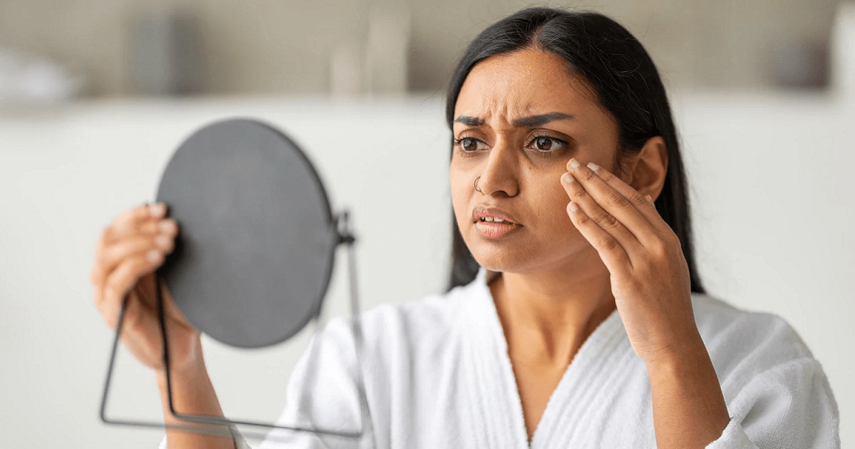 How to Choose the Right Dark Circle Treatment for Your Skin Type