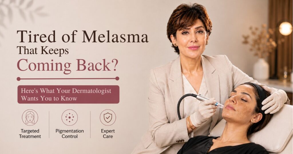 Melasma Treatment in Islamabad