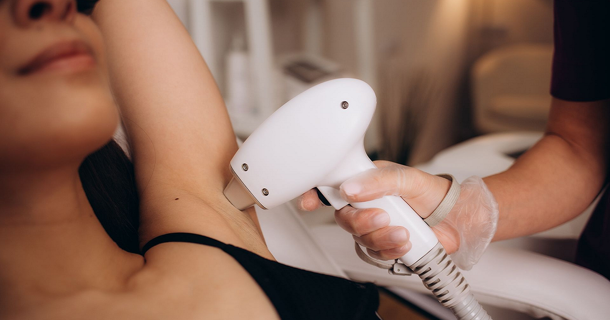 The Ultimate Guide to Smooth Skin with Laser Hair Removal