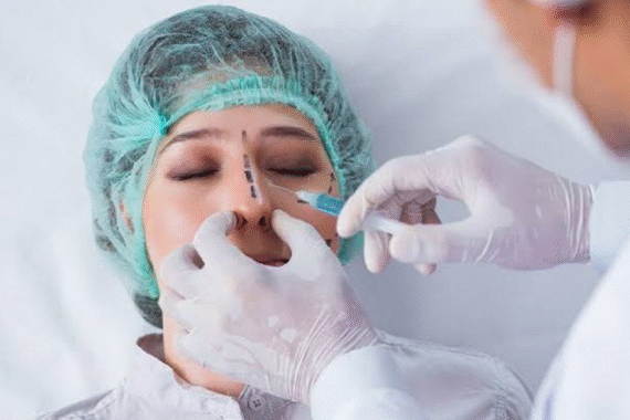 How to Prepare for Rhinoplasty Surgery